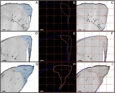 Hippocampal Astrocytes in Migrating and Wintering Semipalmated Sandpiper Calidris pusilla